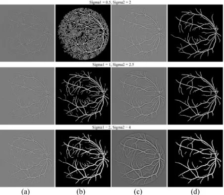 Fig 3. Comparison of the setting of parameter σ on different scales. (a) Thin vessel enhanced image