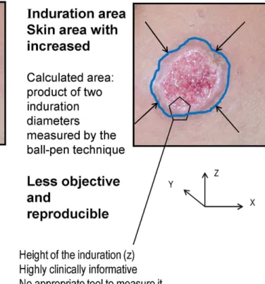 Table 1 illustrates how to apply the different entry criteria based on the type of study (Phase 2–4) and treatment being tested (systemic or topical)