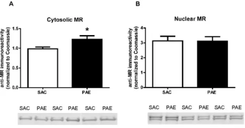 Figure 4. Cytosolic (A) and nuclear (B) levels of the mineralocorticoid receptor (MR) in the medial frontal cortex of saccharin (SAC) control and prenatal alcohol exposure (PAE) offspring