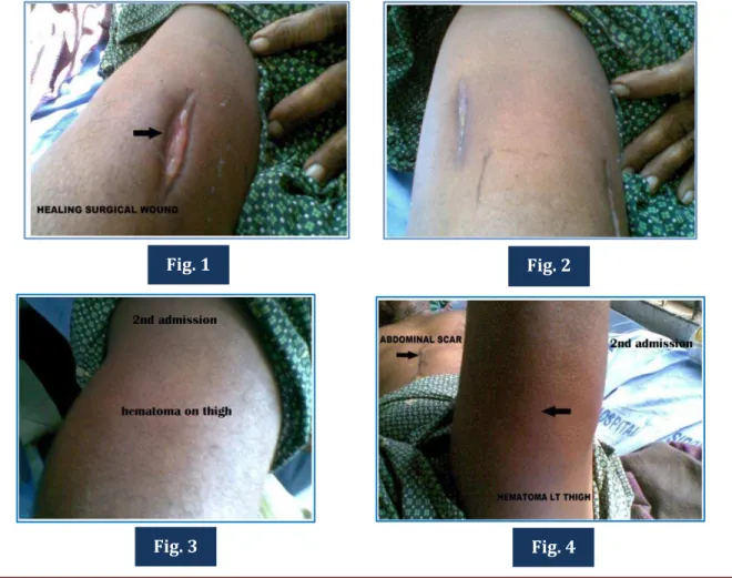 Fig. 1  Fig. 2 