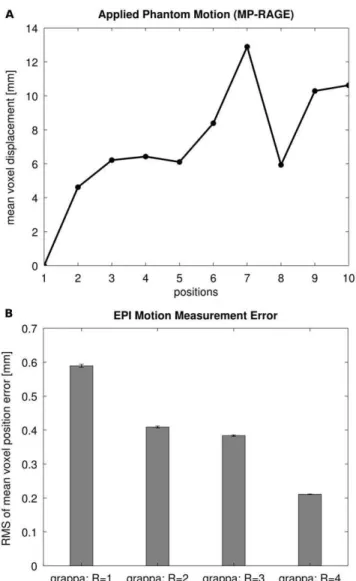 Figure 4A shows the mean voxel displacement calculated from the reference motion parameters acquired from the MP-RAGE