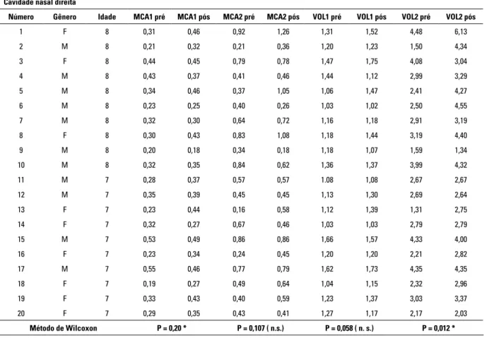 Tabela 1 - Medidas das MCA1, MCA2, VOL1 e VOL2  de cavidade nasal direita pré e pós-disjunção maxilar, análise estatística  segundo método de Wilcoxon  e respectivos resultados estatísticos.