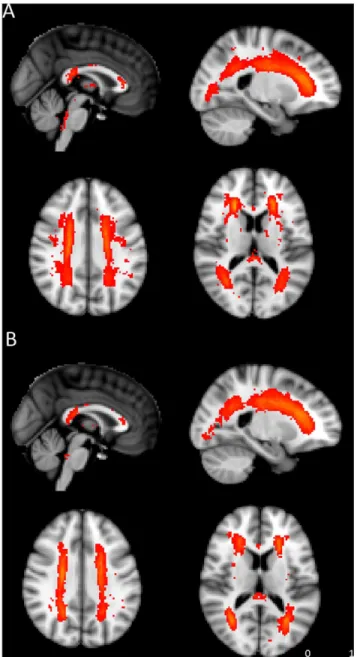 Figure 3. Probability maps of white matter hyperintensities (WMHs) from early (A) and late aMCI (B)
