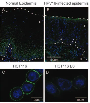 Figure 1. HPV16-infected epidermis displays lowered and irregular E-cadherin staining HPV16 E6 expressing cells have reduced E-cadherin expression