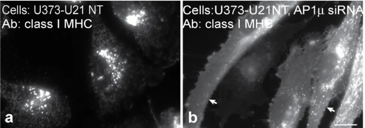 Figure 6. Tailless U21 is affected by depletion of adaptor complexes. Immunofluorescence analysis of class I MHC molecules in tailless-U21- tailless-U21-expressing cells (U21NT), 2 (a) and + (b) AP-1m shRNA expression, as indicated