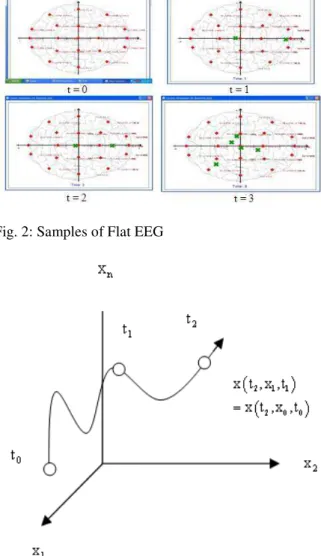 Fig. 2: Samples of Flat EEG 