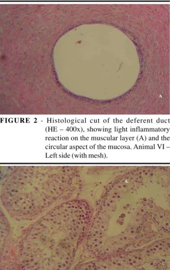 FIGURE 3 - Histological cut of the testis (HE – 400x) showing the marked reduction of spermatogenesis (A).