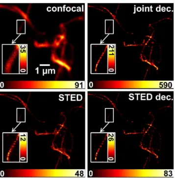 Fig 4. Joint deconvolution of STED images. Left: confocal and STED contribution, derived from offline time gating of the emission from one pulsed STED image acquisition run (STED power of 5 mW at a 2.5 MHz repetition rate) of STAR635-phalloidin labeled in 