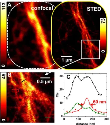 Fig 5. Measurements of in vitro F-actin filaments stained with Atto647N-phalloidin. (A) Diffraction- Diffraction-limited and-unDiffraction-limited images of a gated STED acquisition of a filament structure attached to the glass cover slip and labeled with 