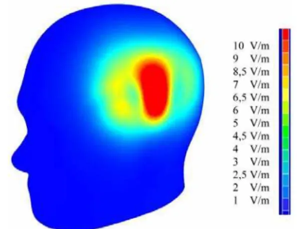 Figure 5 displays the distribution of mobile phone elec- elec-tric field strength during conversation over the mobile phone  of 0.6 W/kg SAR, 0.25 W maximum power, 1,800 MHz  used frequency