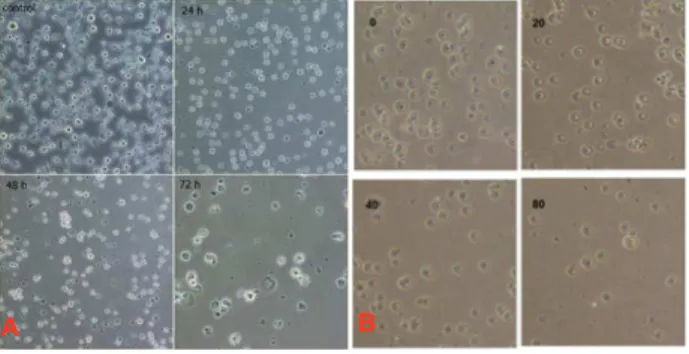 Figure 1. A: Decrease of cell viability in the presence of GA  after 24, 48 and 72 hours (time-dependent)