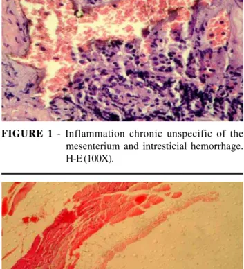 FIGURE 2 - Fragment of the parietal peritoneum without histological alterations. HE (100X).