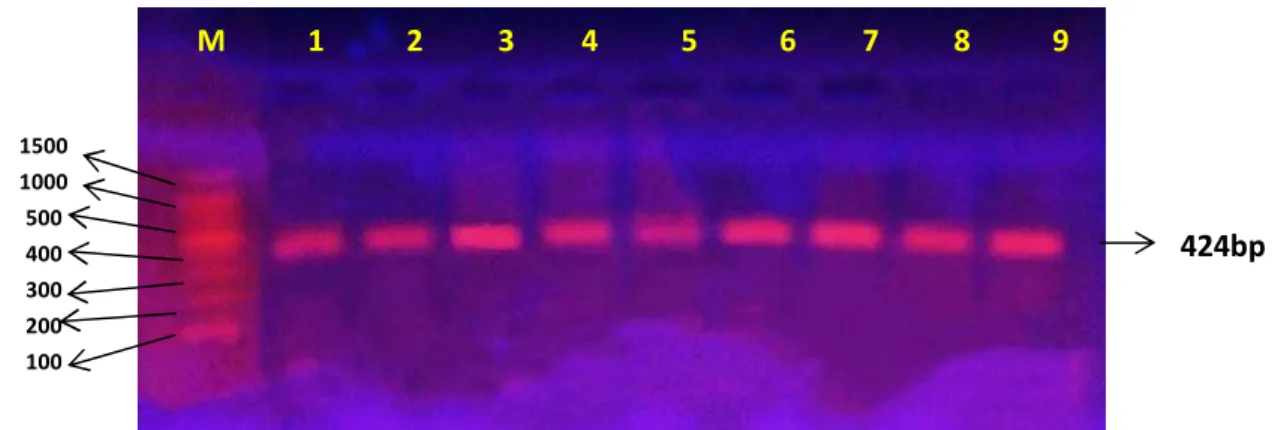 Figure 3  Electrophoresis of PCR production on 2% agarose gel, Lane 1 to Lane 9 Aero gene,  Lane M marker DNA standard (100-1500) bp 