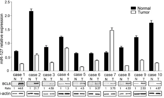 Figure 6. Expression levels of miR-127 and BCL6 in normal breast tissues and primary breast tumors