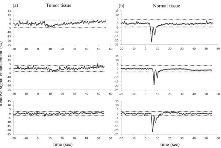 Figure 2. Signal amplitude change of DSC on tumor tissue (left column) and normal tissue (right column)