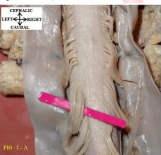 Fig : 1 – A , show s t he dorsal surface of t he spinal cord at  cervical level. Number of dorsal root let s in cervical  level is  counted on  bot h sides