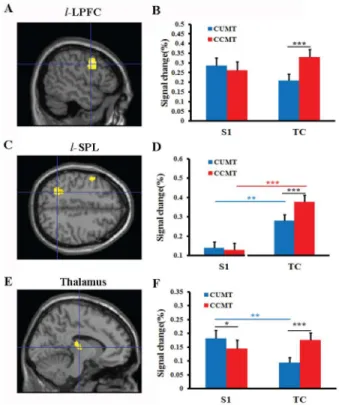 Figure 4. The ROI analysis of Brain activations to S1 stimulus and task. A and B (l-LPFC, X = 250): left lateral prefrontal cortex; C and D (l-SPL, Z = 44): left superior parietal lobe; E and F (Thalamus, X = 210);