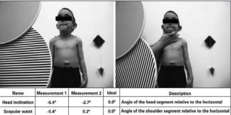 Figure 2. Scheme of the positioning of the equipment and measurements for test  pre sentation.