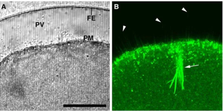 Figure 5. Sequestration of PIP2 by RFP-PH causes structural changes in the subplasmalemmal actin network