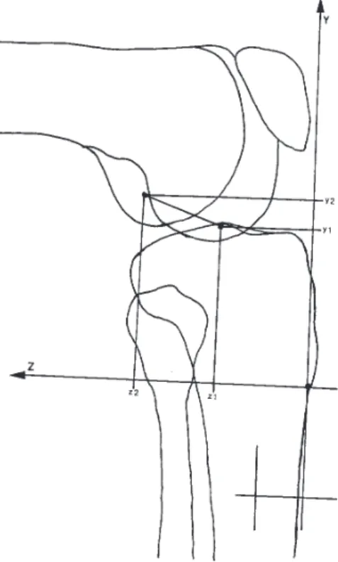 Figure 3 - Radiograph of an anterior-posterior view of the knee in extension 0° (specimen no