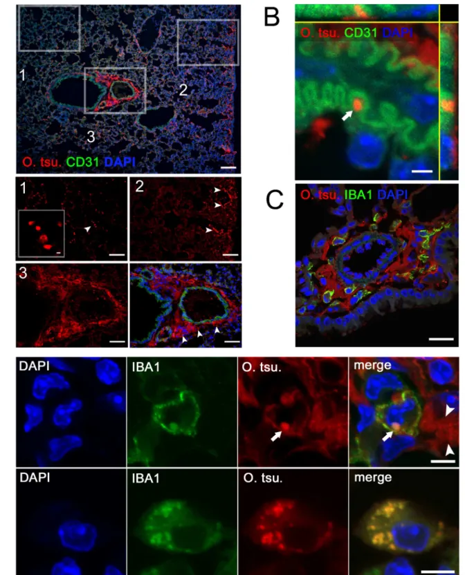 Figure 6. Localization of O. tsutsugamushi by immunohistochemistry in the lung. Balb/c mice were infected with 5 6 10 3 sfu of O.