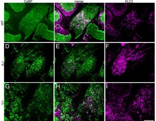 Figure 7. KLC3 immunolabeling reveals that ectopic Purkinje cells do not intermingle with the deep cerebellar nuclei