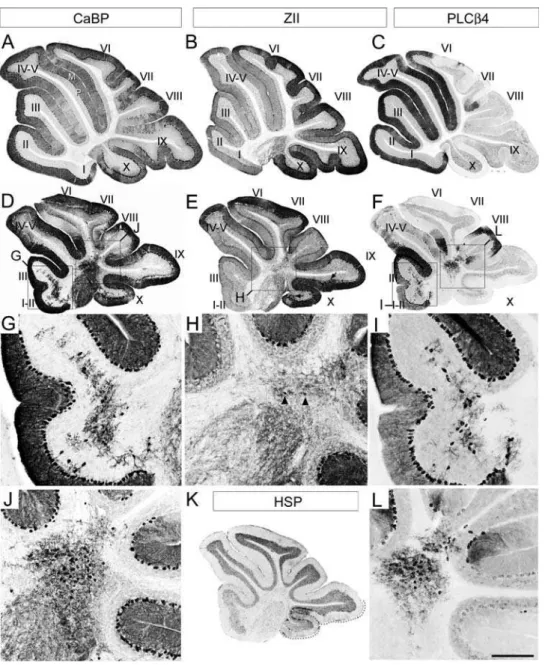 Fig. 2J and Fig. 2L). As expected, since the NZ is almost completely zebrin II-immunopositive in the wild type, no PLCß4