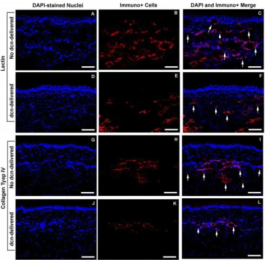Figure 5. Representative images showing CNV in rabbit corneas treated AAV5+/ 2 decorin