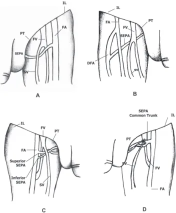 Figure 1 - Types of distribution of the superficial external pudendal artery (SEPA). A) single artery; B) artery originating at the deep femoral artery; C) artery with double origin; D) artery with a common trunk; FA, femoral artery;