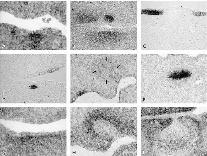 Figure 2 - Bmp-4 (A and B), Shh (C, D, E and F) and Wnt-5a (G, H and I) expression during early tooth development