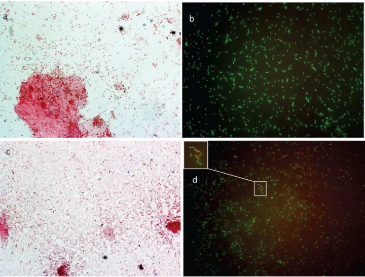 Figure  5.    Fluorescence  micrographs  and  Gram  stain  images  of  vaginal  fluid  smears