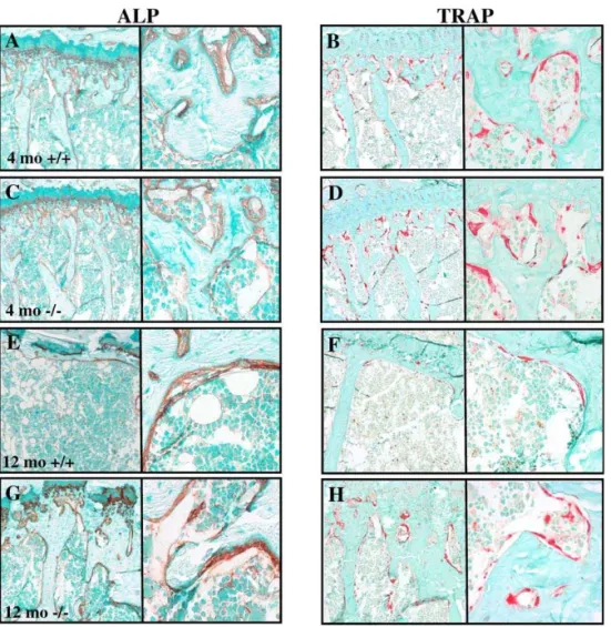 Figure 5. Histologic Analysis of Undecalcified Bone from Sam68 þ/þ and Sam68  /  Mice