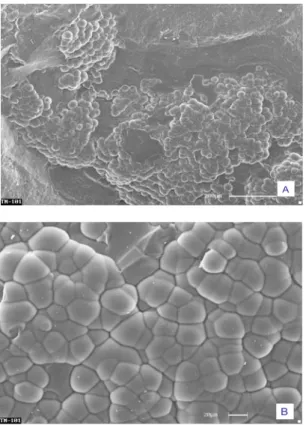 FIGURA 4 - Imagens obtidas ao microscópio eletrônico de varredura. (A) Aspecto geral das formas botrioidais da opala (amostra TM-101); (B) detalhe da imagem anterior.