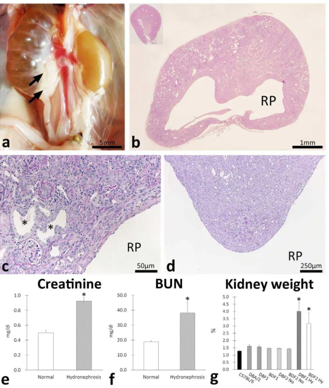 Figure 1. Clinicopathology of hydronephrosis in progenies of C57BL/6 and DBA/2. Gross anatomical features of hydronephrosis in F2 progenies of C57BL/6 and DBA/2 (BDF2) (panel a)