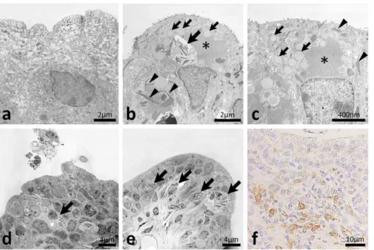 Figure 4. Ultrastructures of the ureteral mucus of F2 mice showing hydronephrosis. In the ureters of normal BDF2 mice, numerous fusiform vesicles were observed in the apical cytoplasm of transitional epithelial cells (panel a) whereas homogeneous, amorphou
