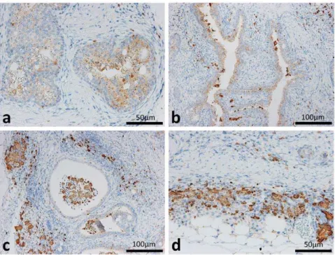 Figure 6. Distributions of Chi3l3/Ym1 protein in the ureters of F2 mice showing hydronephrosis