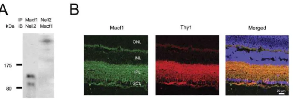 Figure 6. Electroporation-mediated in vivo transfection of RGCs with Nell2 expression construct