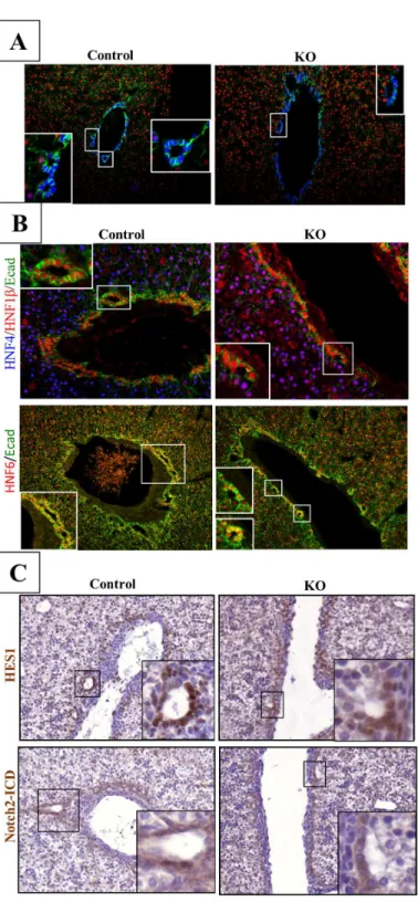 Fig 3. Lkb1 controls the maturation of bile duct during bile duct tubulogenesis. (A)
