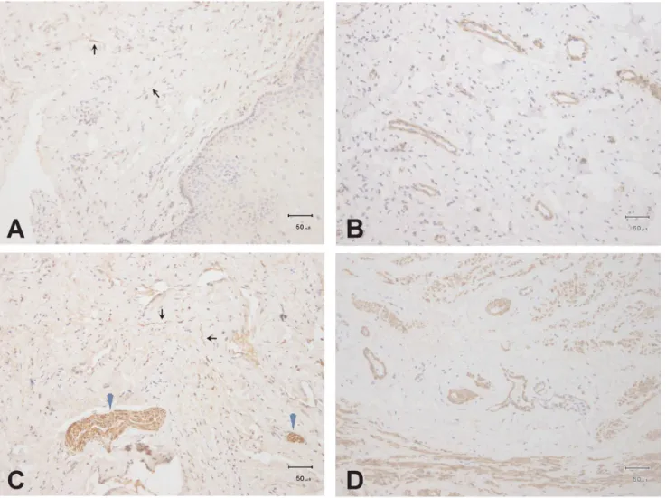 Figure 1. PGP9.5 immunostaining: Vaginal tissue sections from the lamina propria layer (A) and muscle layer (C), nerve bundles SMA immunostaining: Vaginal tissue sections from the 6 magnification).