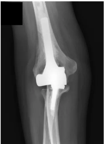 Figure 1 – Radiographic follow-up
