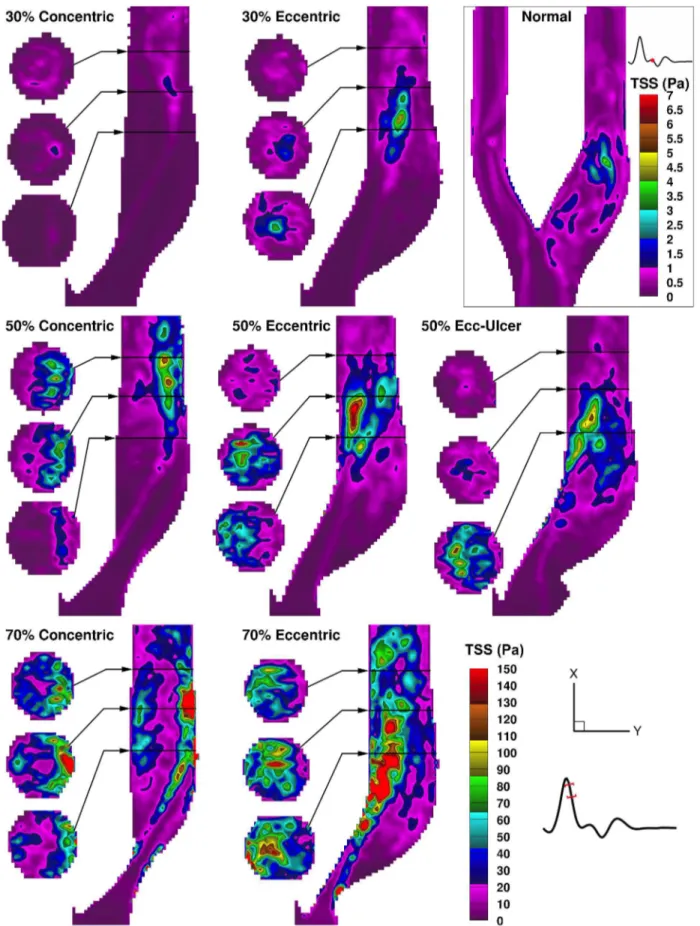 Figure 11. Color-encoded maps of total shear stress for the time point of maximum TSS in each of the eight carotid models