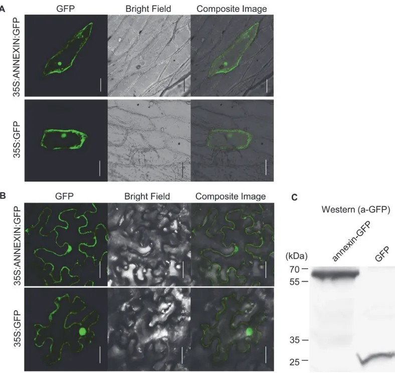 Fig 3. Subcellular localization of Ha-ANNEXIN in the plant cell. (A) pUC35S:ANNEXIN:GFP fusion construct and pUC35S:GFP control construct were transformed into onion epidermal cells by bombardment