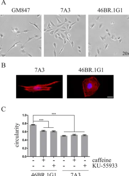 Fig 1. Correction of LigI defect affects cell morphology. A) Time-lapse imaging of cell migration