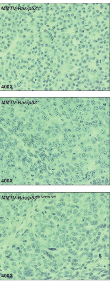 Fig 4. H&amp;E staining of representative tumor of the three genotypes. Top: MMTV-Hras/p53 +/+ ; middle: