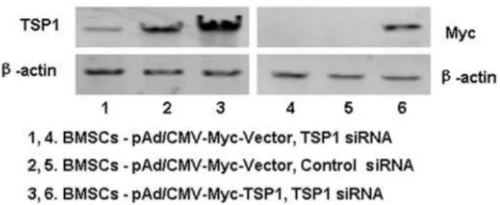 Figure 5. Morphological changes of BMSCs after co-culturing with RGCs when TSP-1 was silenced with siRNA and rescued by infection with a recombinant adenovirus expressing TPS1