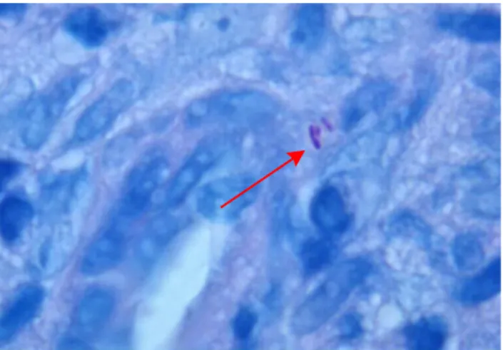 Figura  3  -  Fite  Faraco.  Identificação  de  bacilos  Mycobacterium  leprae.