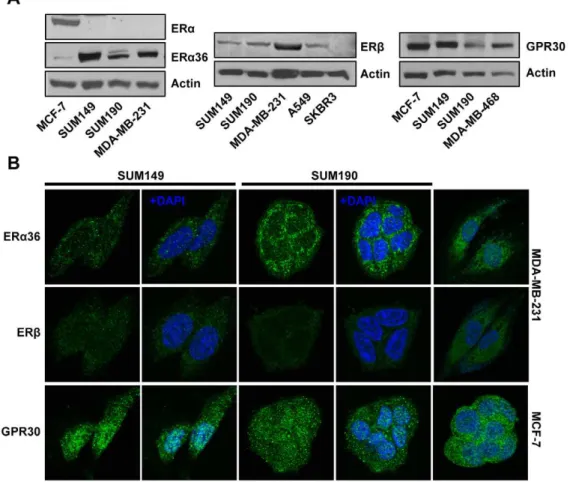 Figure 1. Estrogen receptor expression profiling in IBC cell lines SUM149 and SUM190. (A) Western blot analysis of ERa36, ERb and GPR30 (B) Immunofluorescent localization of ERa36, ERb and GPR30