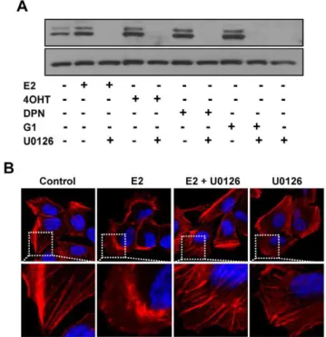 Figure 4. Effect of MEK inhibitor U0126 on p-ERK1/2 activation and cytoskeletal remodeling induced by estrogen receptor ligands and antiestrogens