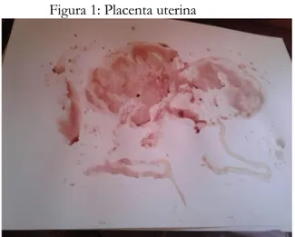 Figura 1: Placenta uterina 
