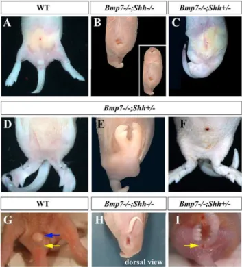 Fig. 1C). The hindlimb fusion in Bmp7 2 / 2 ;Shh + / 2 mutants ranged from a partial merging at proximal/tight level (Fig